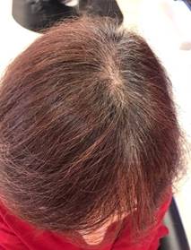 世界初 病気や治療 加齢で細く縮れた髪 ちりめん髪 を補修 大阪 西淀川の美容院で２月１日から ちりめん髪補修外来 を開始 美容業界初の特許も取得 病気が原因の方は無料診断も Prでっせ